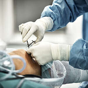 Close-up of surgeon’s hands stitching up a patient’s knee after arthroscopic surgery.